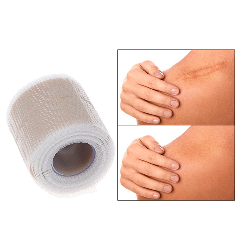 Silicone Scar Sheets – Best Rated Solution for Before & After Care