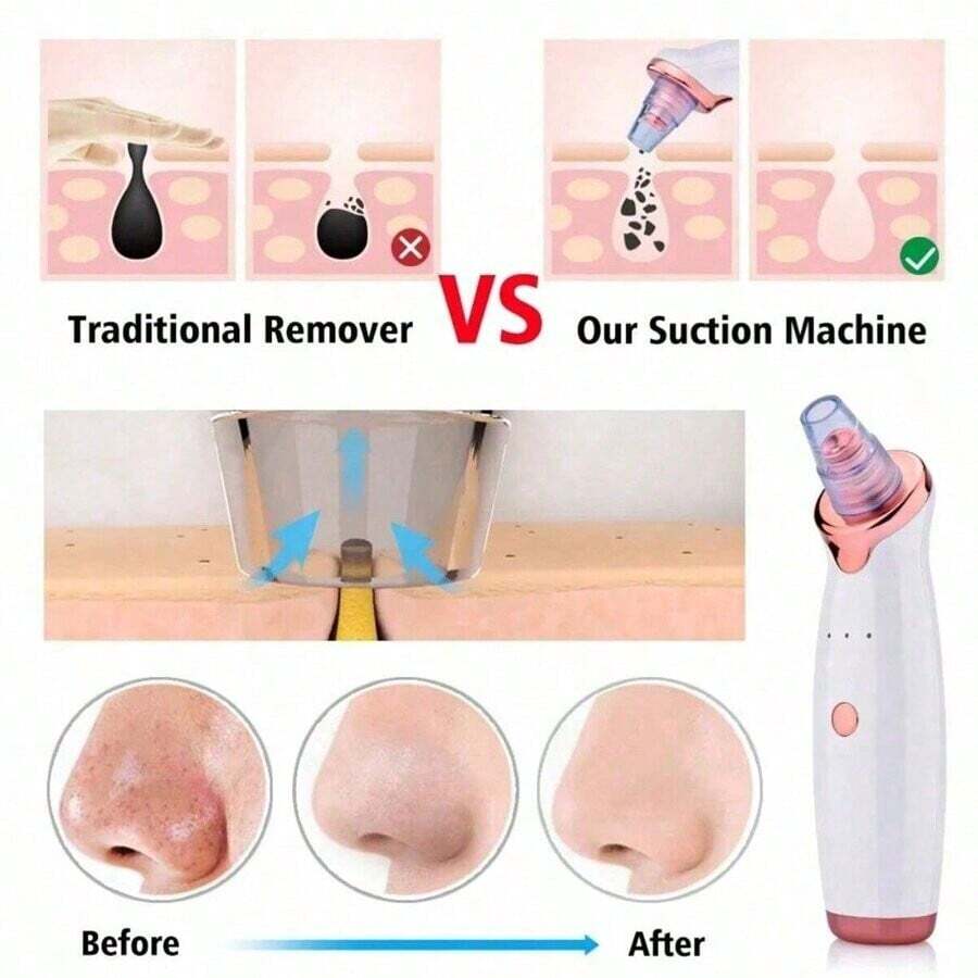 Electric Blackhead Remover | Deep Cleansing, Powerful Suction & Customizable for Clearer Skin at Home