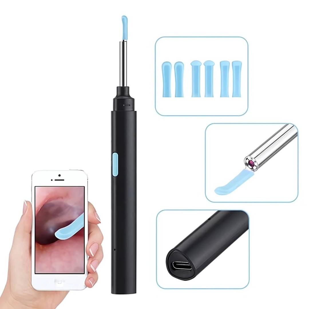 Earwax Removal Tool with LED Camera | Safe, Soft Tips for Gentle Ear Cleaning and Monitoring Ear Health