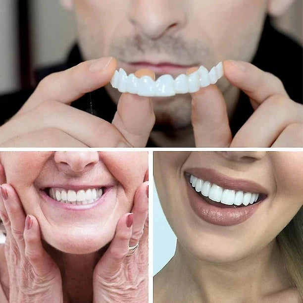 Pop-On Veneers for Instant Smile Makeover | Custom Fit Dental Aesthetic Solution for Teeth Whitening & Gap Coverage