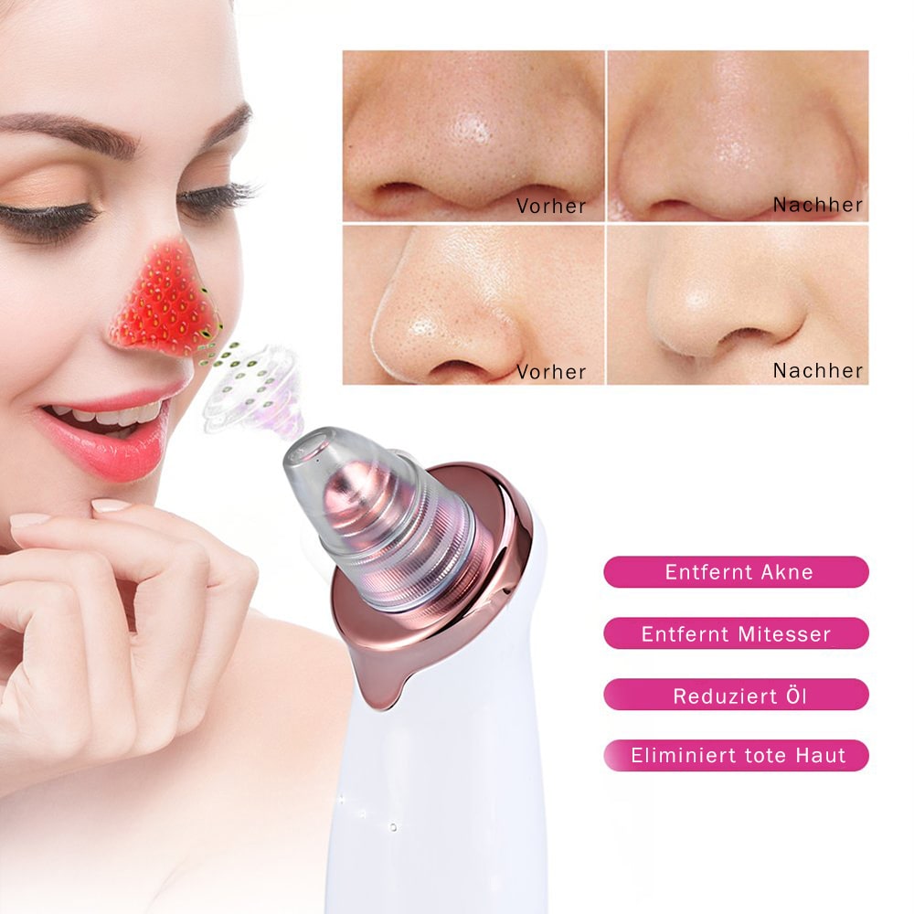 Electric Blackhead Remover | Deep Cleansing, Powerful Suction & Customizable for Clearer Skin at Home