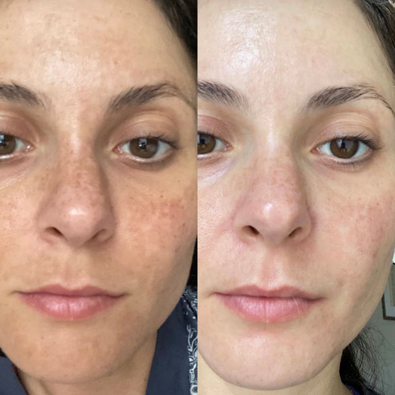 Collagen Lifting Cream | Hydrolysed Collagen & Niacinamide for Firm, Hydrated Skin