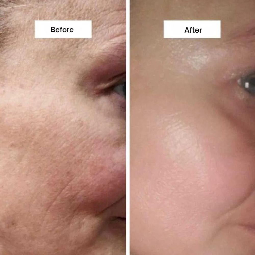 Collagen Lifting Cream | Hydrolysed Collagen & Niacinamide for Firm, Hydrated Skin