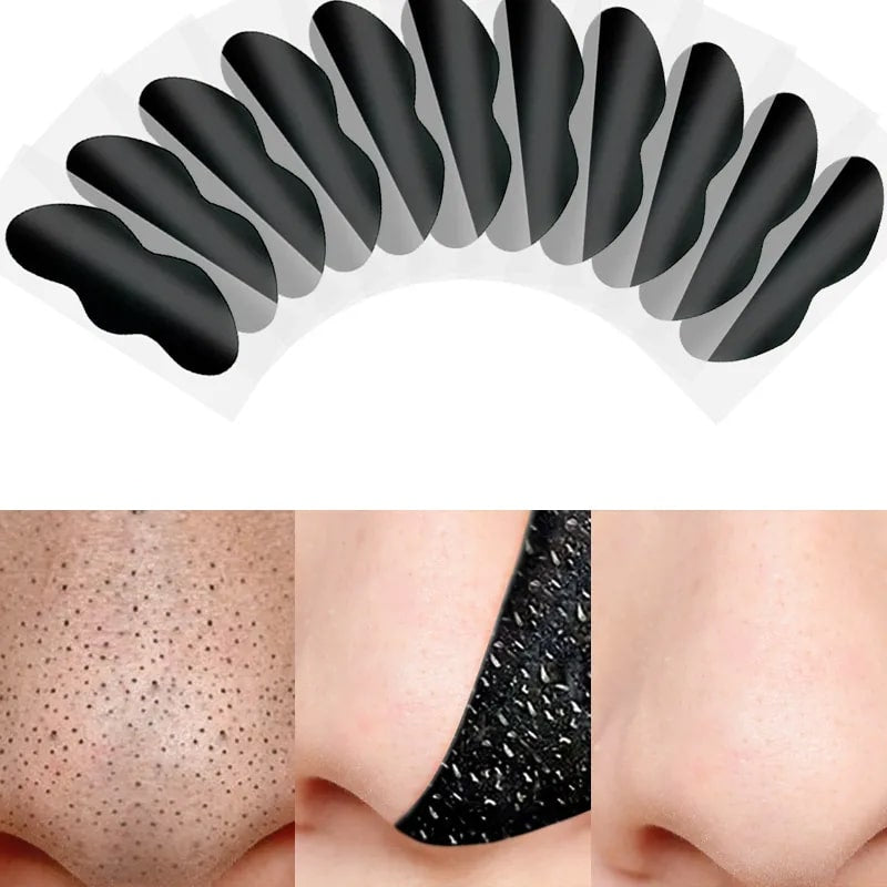 Blackhead Remover Strips | Activated Charcoal, Hypoallergenic & Ideal for Sensitive Skin Types