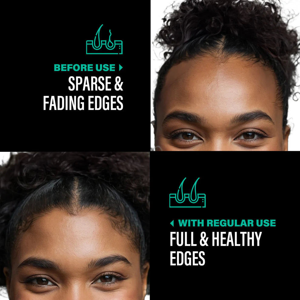 Batana Hair Oil | Sustainably Sourced, Natural Repair & Moisturizing for Healthy Hair Growth
