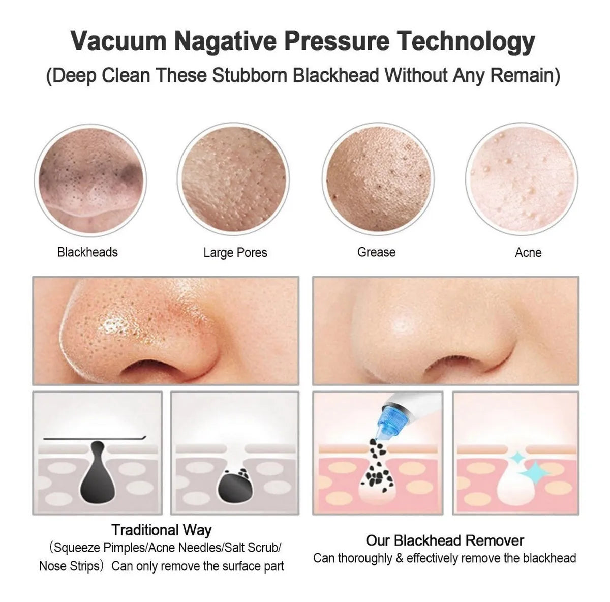 Blackhead Pore Cleaner | Deep Cleansing, Gentle Exfoliation & Skin Tightening for Clear Complexion at Home