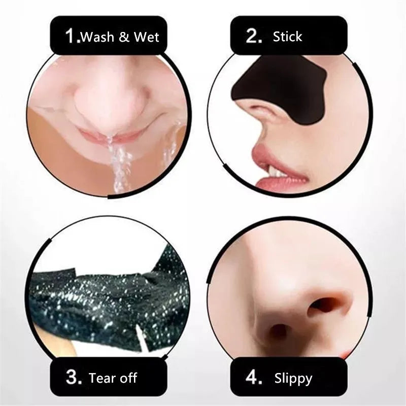 Blackhead Remover Strips | Activated Charcoal, Hypoallergenic & Ideal for Sensitive Skin Types