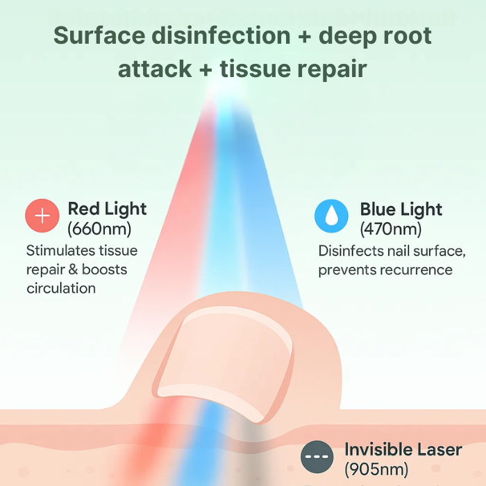 Fungal Nail Treatment Device – Fast & Effective Onychomycosis Solution