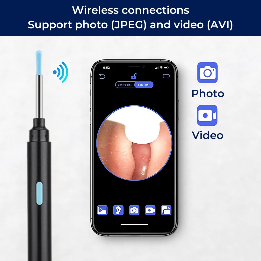 Earwax Removal Tool with LED Camera | Safe, Soft Tips for Gentle Ear Cleaning and Monitoring Ear Health