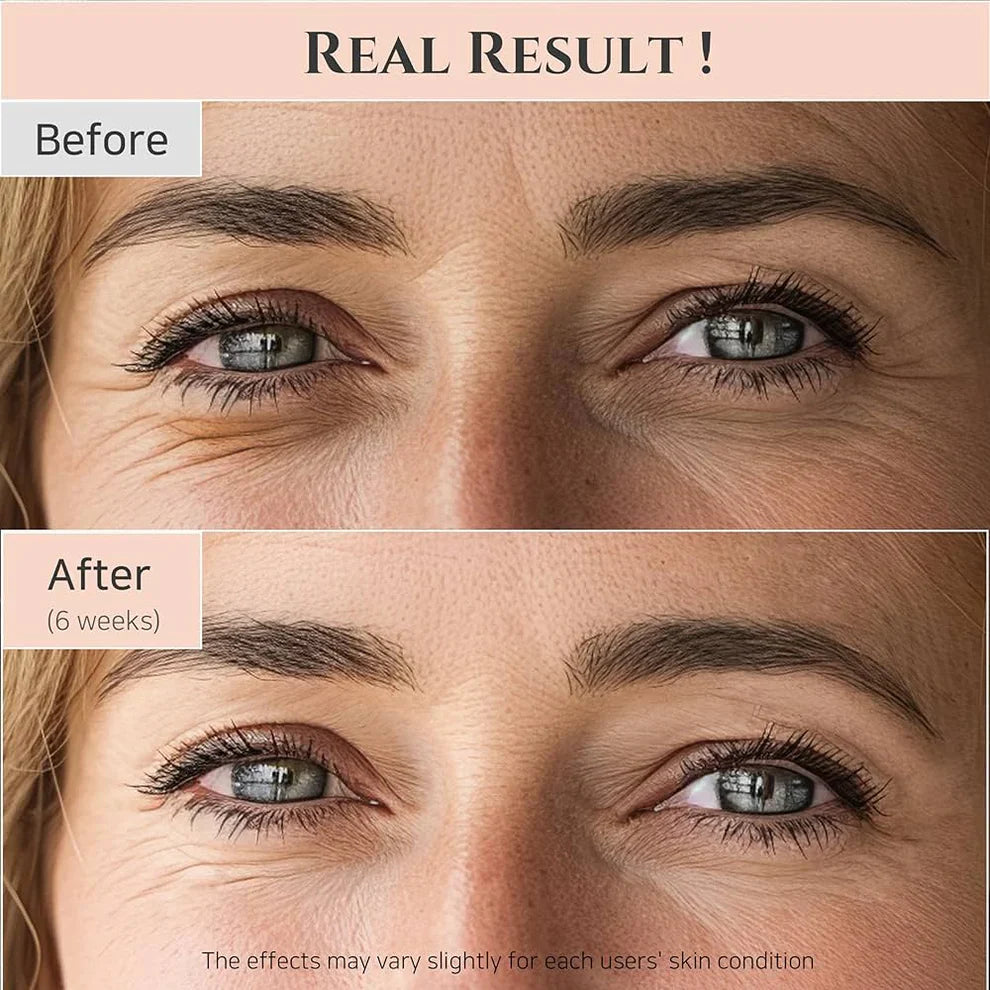 Korean Formula Eye Cream | Anti-Aging, Hydrating Formula with Ginseng & Retinal for Dark Circles and Fine Lines
