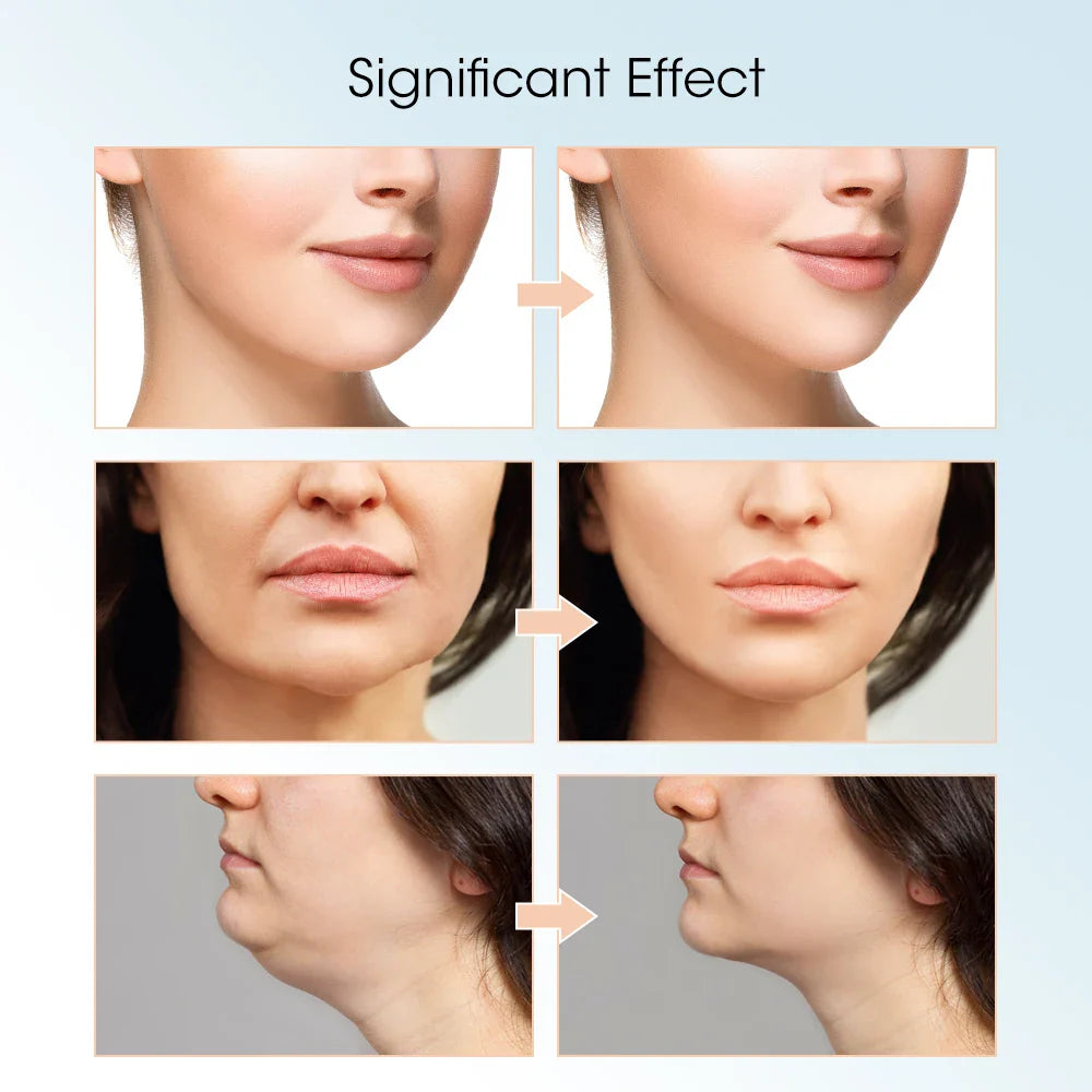 Slimara™ | Face Slimming Lifting Device Massager for Skin Rejuvenation & Double Chin Reduction