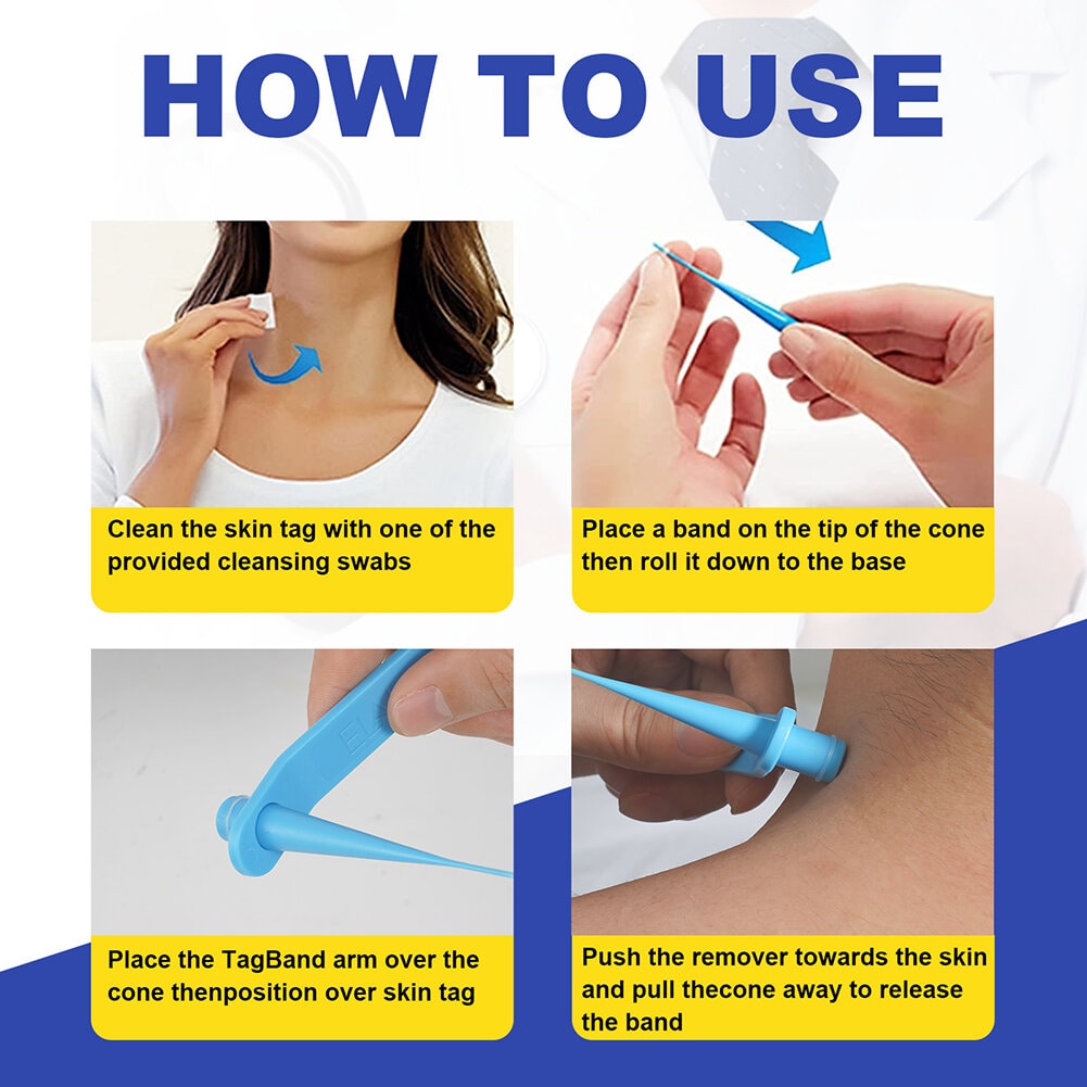 Skin Tag Removal Kit | 2-in-1 Silicone Band Ligation System for Safe and Gentle Home Use