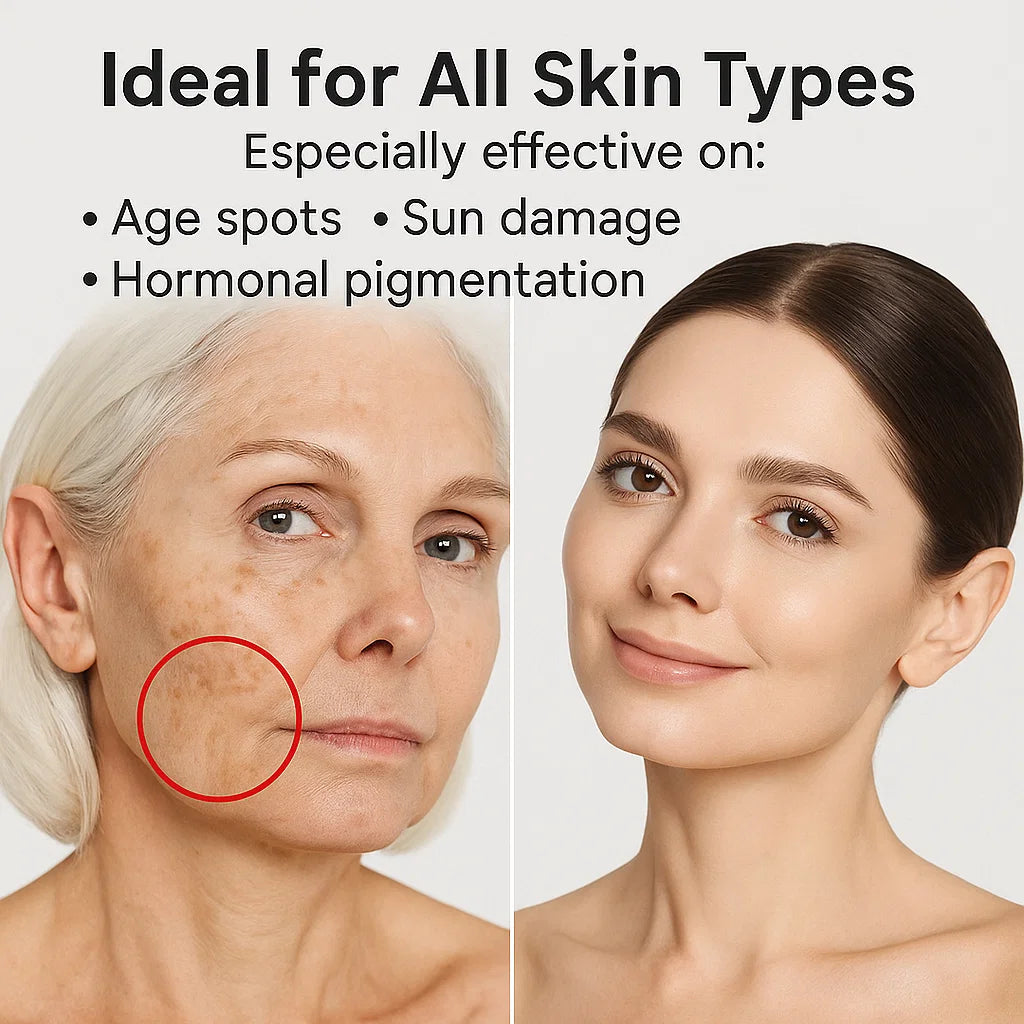 Whitening Freckle Cream for Dark Spot Removal and Skin Brightening - Effective Treatment for Hyperpigmentation and Uneven Skin Tone