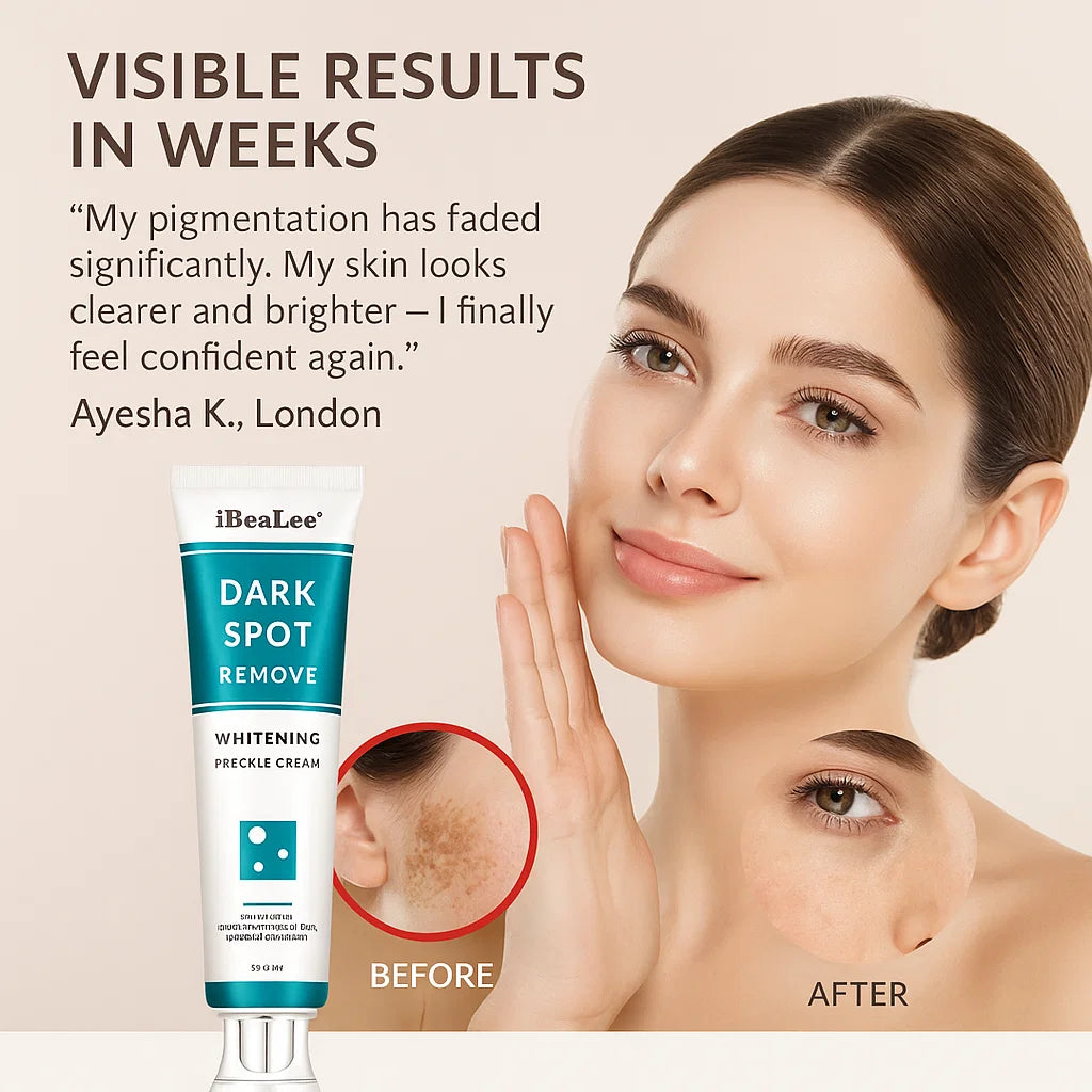 Whitening Freckle Cream for Dark Spot Removal and Skin Brightening - Effective Treatment for Hyperpigmentation and Uneven Skin Tone