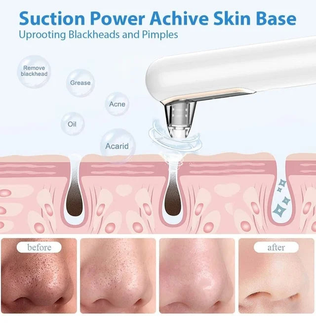 Blackhead Pore Cleaner | Deep Cleansing, Gentle Exfoliation & Skin Tightening for Clear Complexion at Home