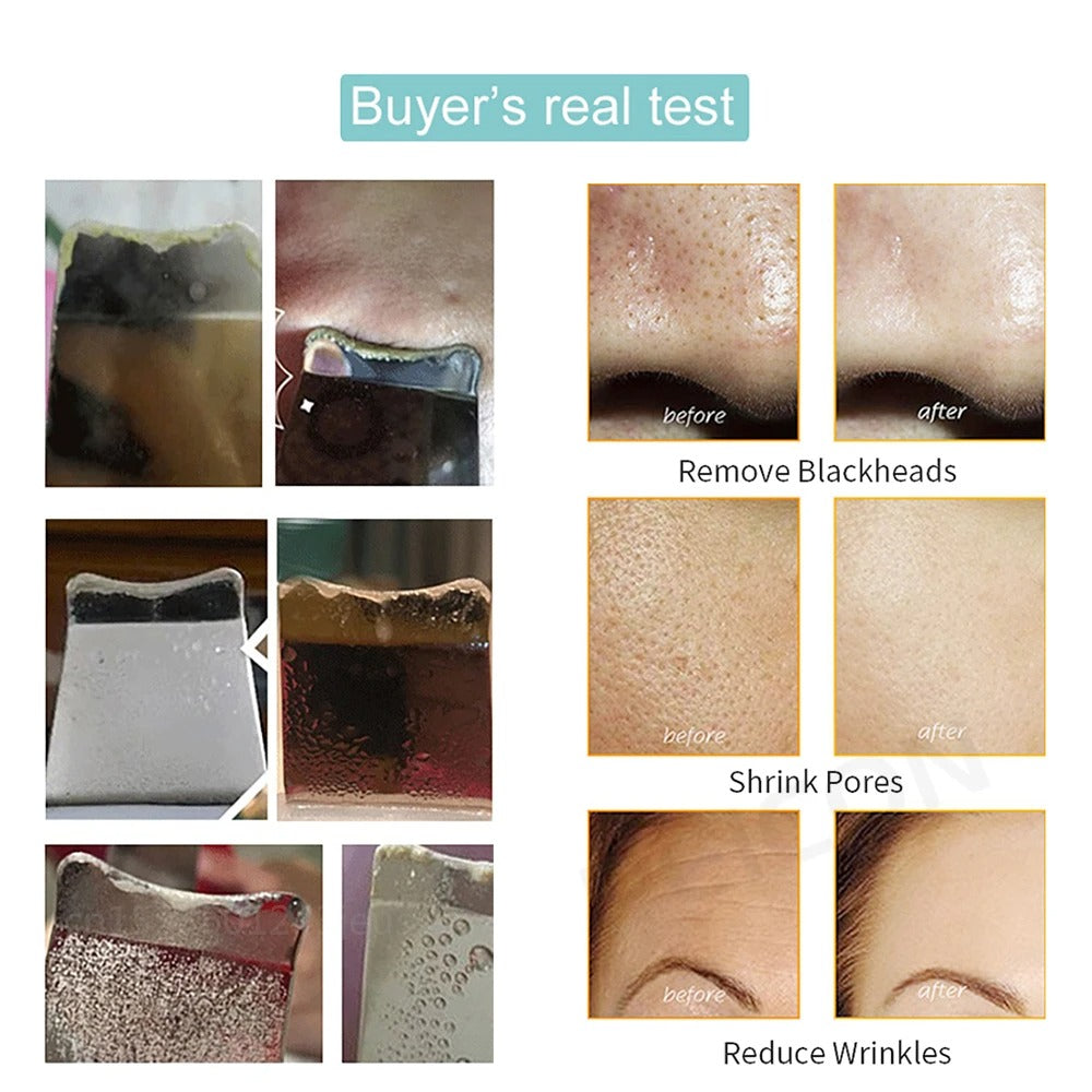 Ultrasonic Face Scrubber – Deep Cleansing & Exfoliating Wand for Radiant Skin