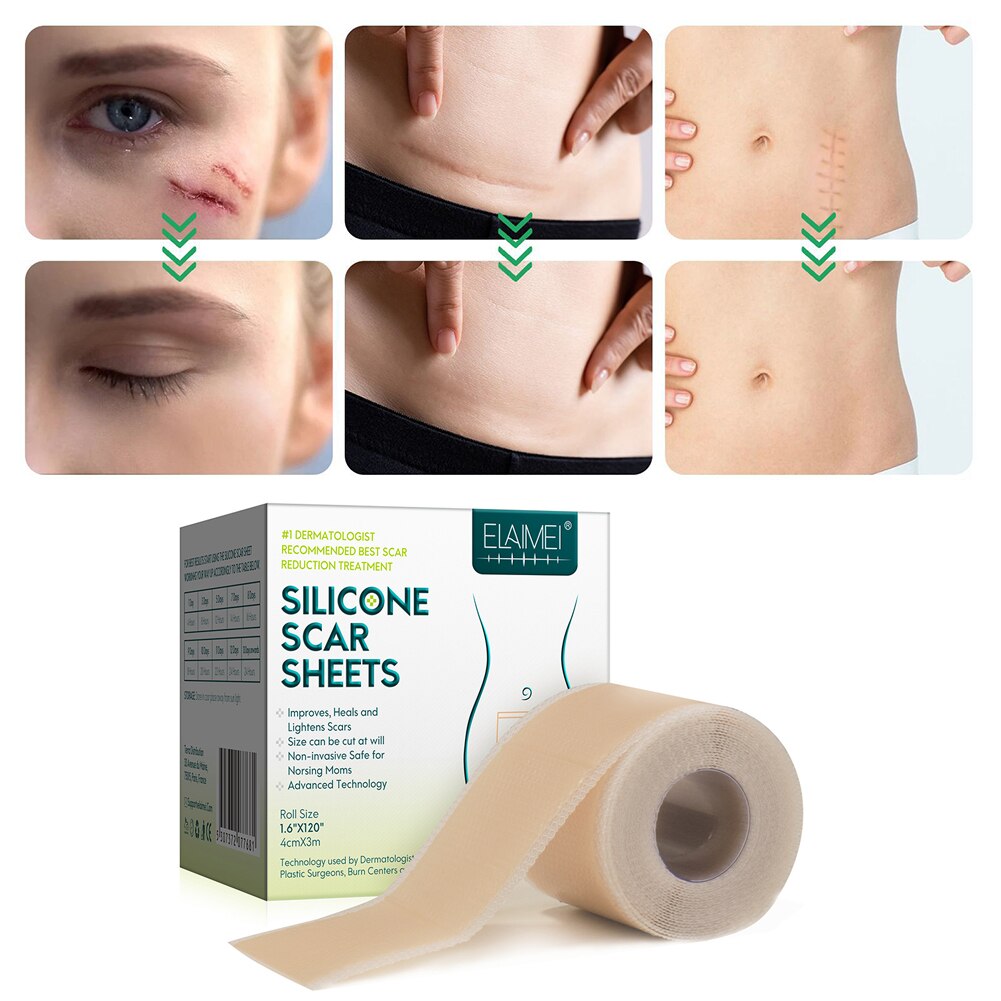Reusable Silicone Scar Reduction Sheets - Medical Grade Silicone for Effective Scar Treatment and Healing