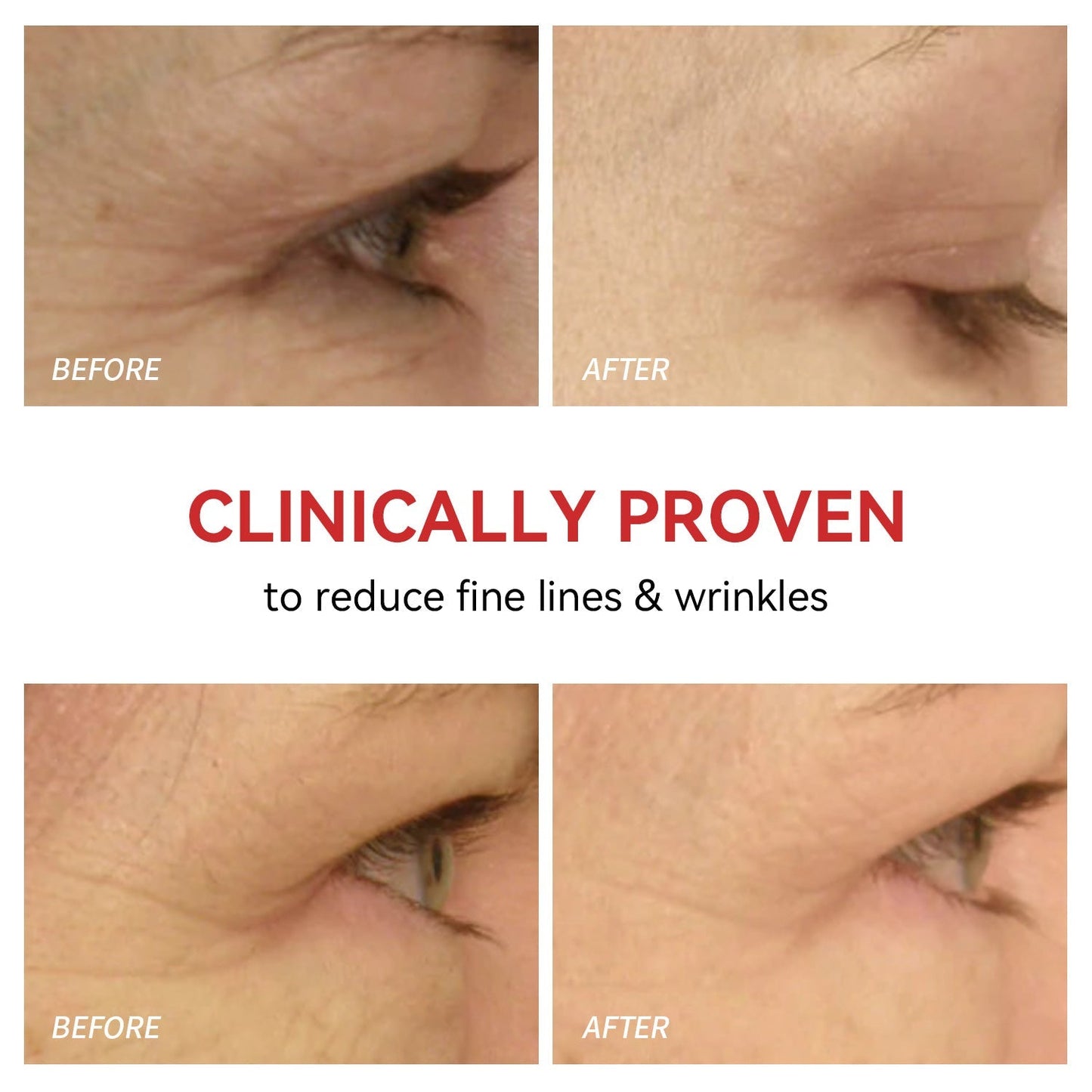 Red Light Therapy Device for Eyes | Reduces Fine Lines, Promotes Collagen & Effortless 3-Minute Daily Routine