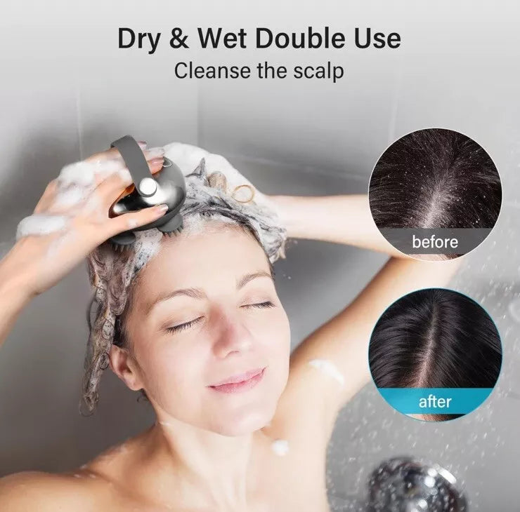 Electric Scalp Massager | Waterproof, USB Rechargeable & Ergonomic Design for Deep Relaxation and Hair Growth Stimulation
