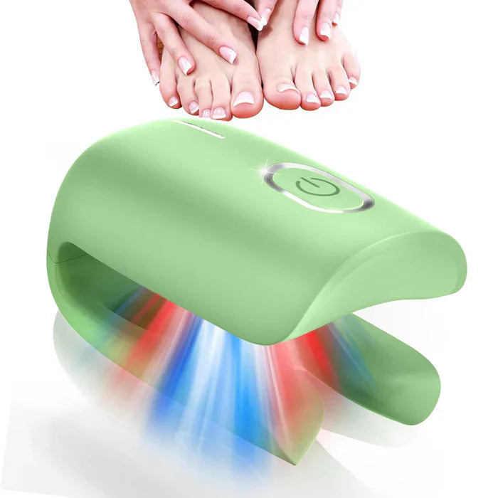 Fungal Nail Treatment Device – Fast & Effective Onychomycosis Solution