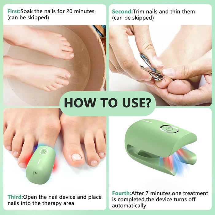 Fungal Nail Treatment Device – Fast & Effective Onychomycosis Solution