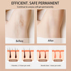 Profesional IPL Laser Hair Removal Machine - Effective Home Hair Trimmer Removal Tool