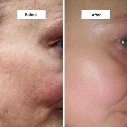 Collagen Lifting Cream | Hydrolysed Collagen & Niacinamide for Firm, Hydrated Skin
