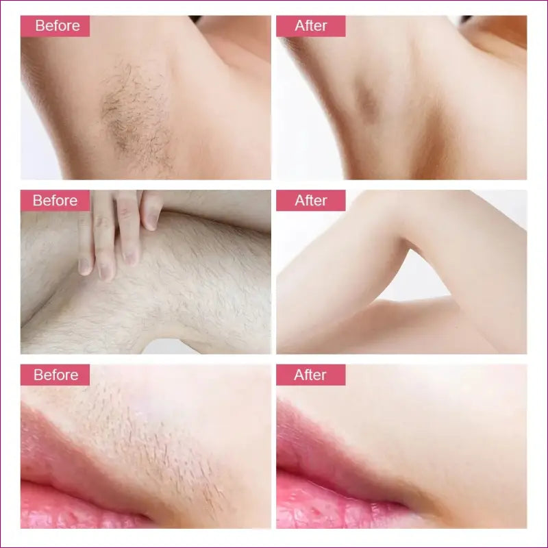 Profesional IPL Laser Hair Removal Machine - Effective Home Hair Trimmer Removal Tool
