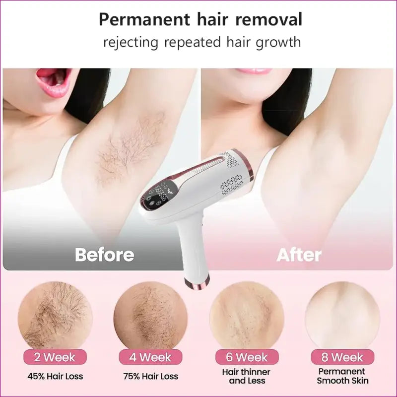 Profesional IPL Laser Hair Removal Machine - Effective Home Hair Trimmer Removal Tool