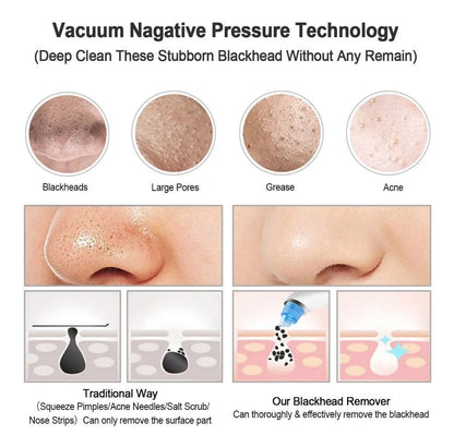 Blackhead Pore Cleaner | Deep Cleansing, Gentle Exfoliation & Skin Tightening for Clear Complexion at Home