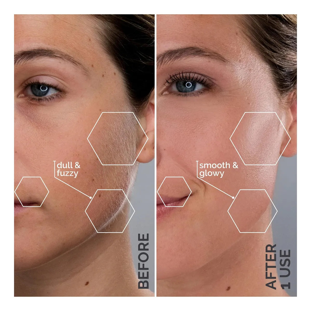 Sonic Dermaplaning Device | Microfine Edges for Smooth Skin & Enhanced Skincare Absorption