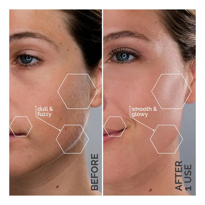 Sonic Dermaplaning Device | Microfine Edges for Smooth Skin & Enhanced Skincare Absorption