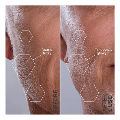 Sonic Dermaplaning Device | Microfine Edges for Smooth Skin & Enhanced Skincare Absorption