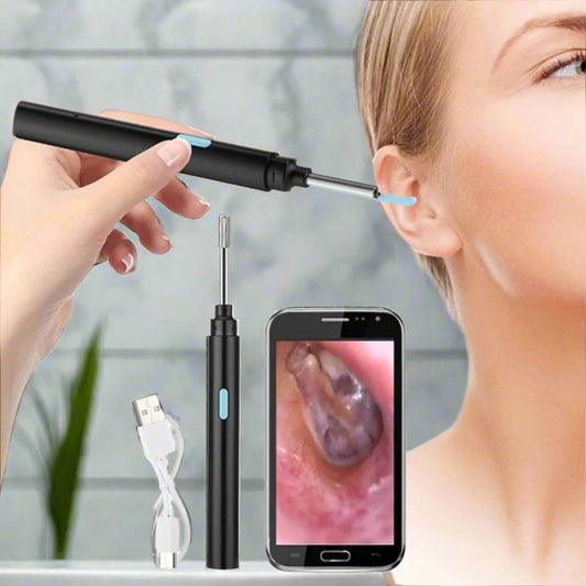 Earwax Removal Tool with LED Camera | Safe, Soft Tips for Gentle Ear Cleaning and Monitoring Ear Health