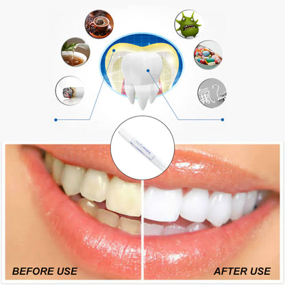 Tooth Paint Whitening Pen – Fast and Effective Teeth Whitening Essence for Instant Results