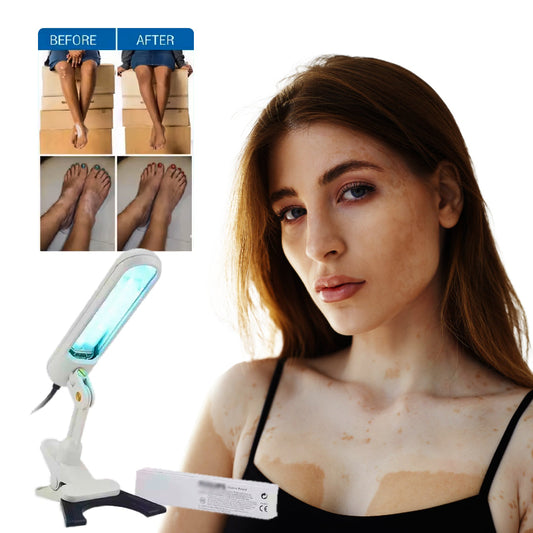 UVB Light Therapy for Psoriasis | At-Home Treatment of Eczema and Skin Conditions