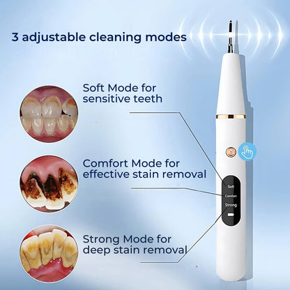 Ultrasonic Teeth Cleaner - Plaque Remover for Deep Cleaning & Tartar Removal at Home - Dental Hygiene Tool for Teeth Polishing