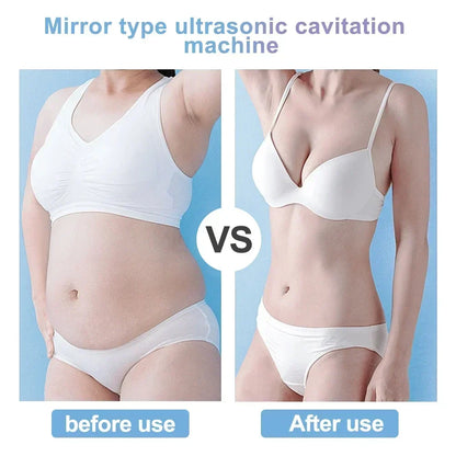 Ultrasonic Cavitation Machine 40K with RF for Facial Lifting, Body Slimming & Weight Loss Treatments