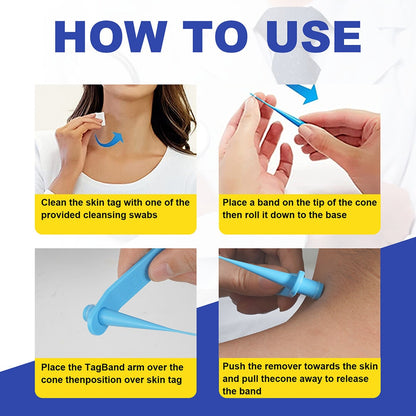 Skin Tag Removal Kit | 2-in-1 Silicone Band Ligation System for Safe and Gentle Home Use