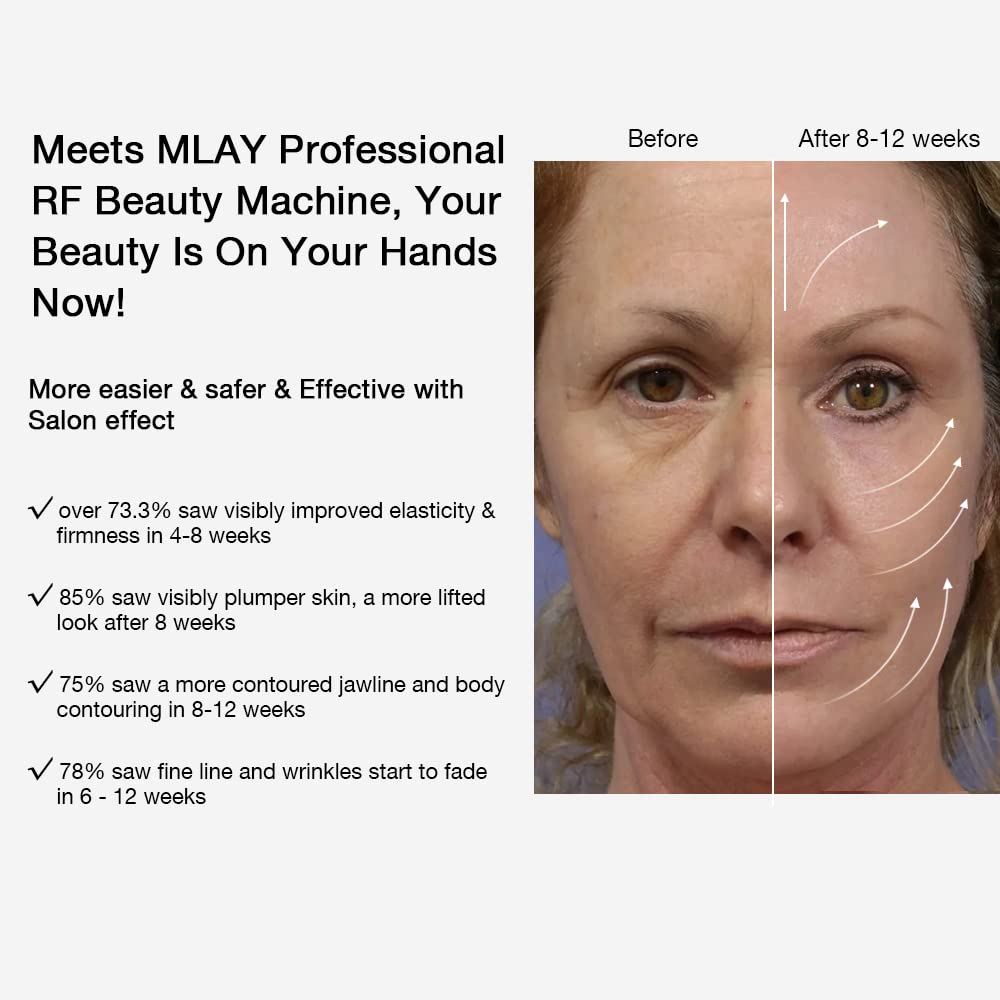 Radio Frequency Skin Tightening Machine – RF Beauty Device for Face Lifting and Wrinkle Removal