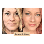 The Instant Neck and face Lift l No Pain Neck Lift Stretch Bands