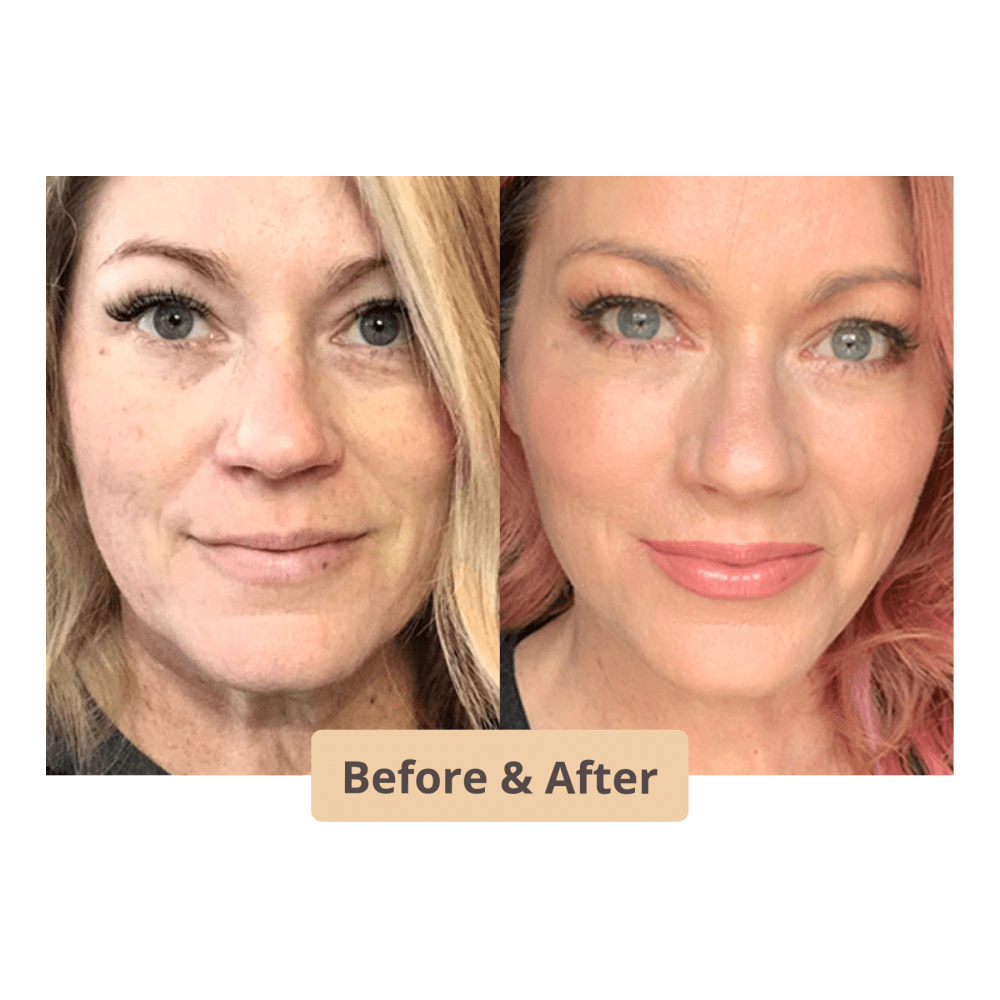 The Instant Neck and face Lift l No Pain Neck Lift Stretch Bands