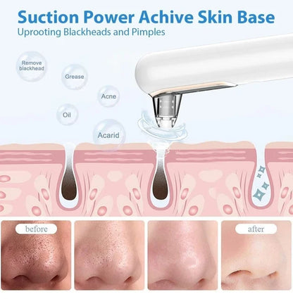 Blackhead Pore Cleaner | Deep Cleansing, Gentle Exfoliation & Skin Tightening for Clear Complexion at Home