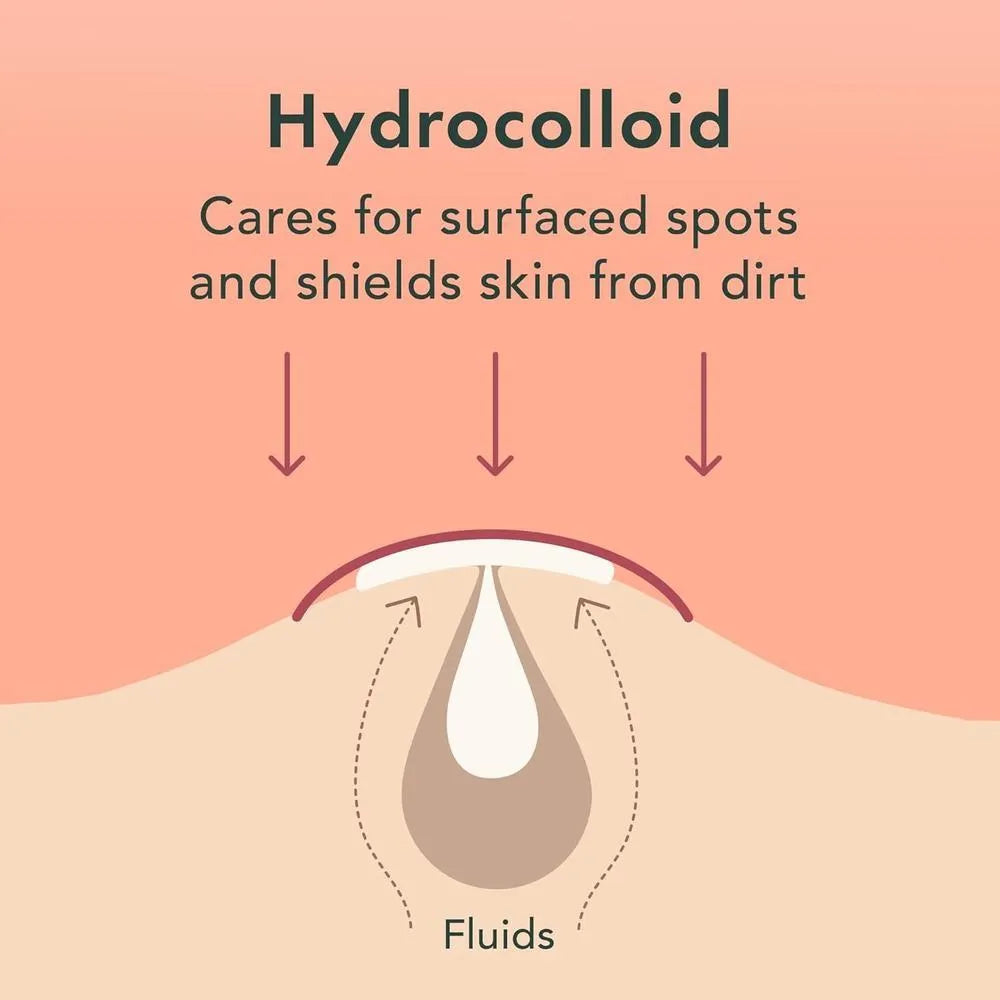 Anti-Pimple Hydrocolloid Patches | Non-Drying, Hypoallergenic & Discreet for All Skin Types
