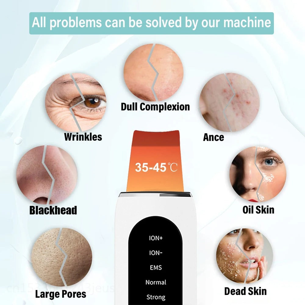 Ultrasonic Face Scrubber – Deep Cleansing & Exfoliating Wand for Radiant Skin