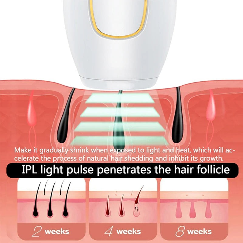 IPL Laser Hair Removal Device – Profesional Home Use for Permanent Hair Reduction