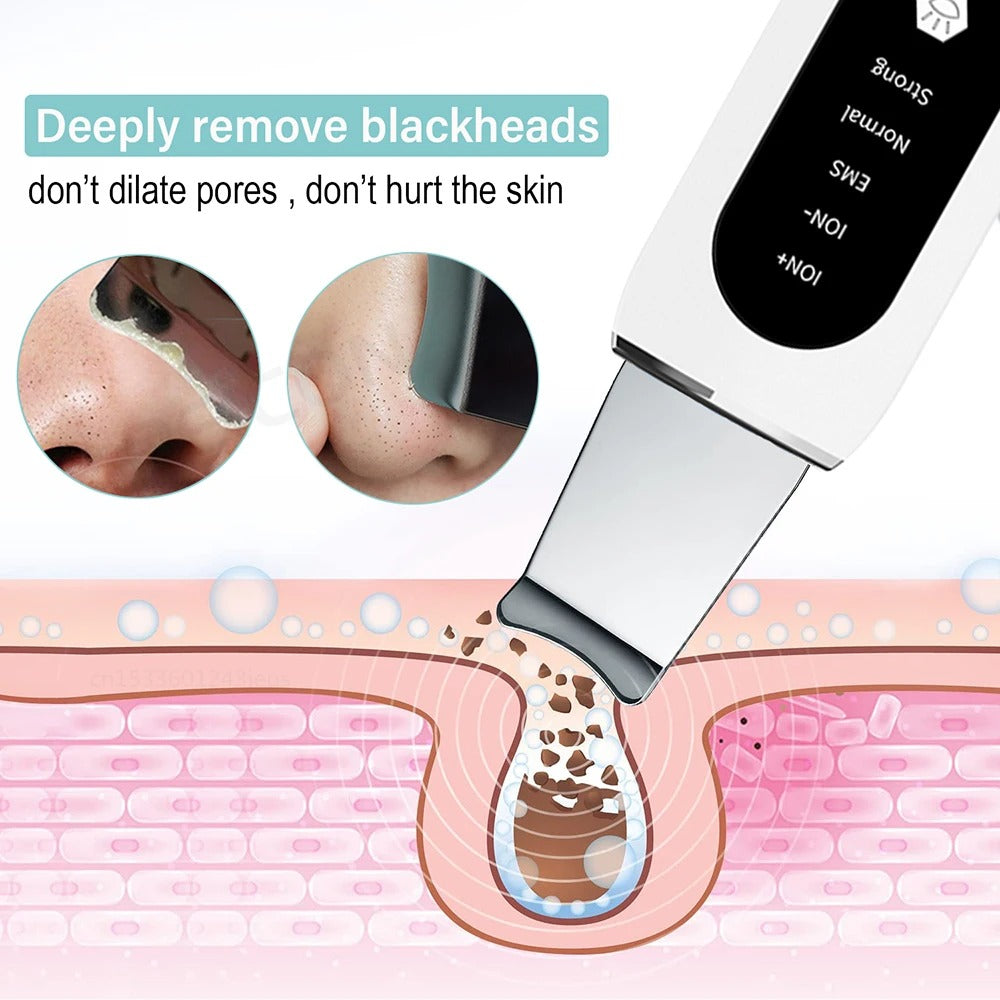 Ultrasonic Face Scrubber – Deep Cleansing & Exfoliating Wand for Radiant Skin