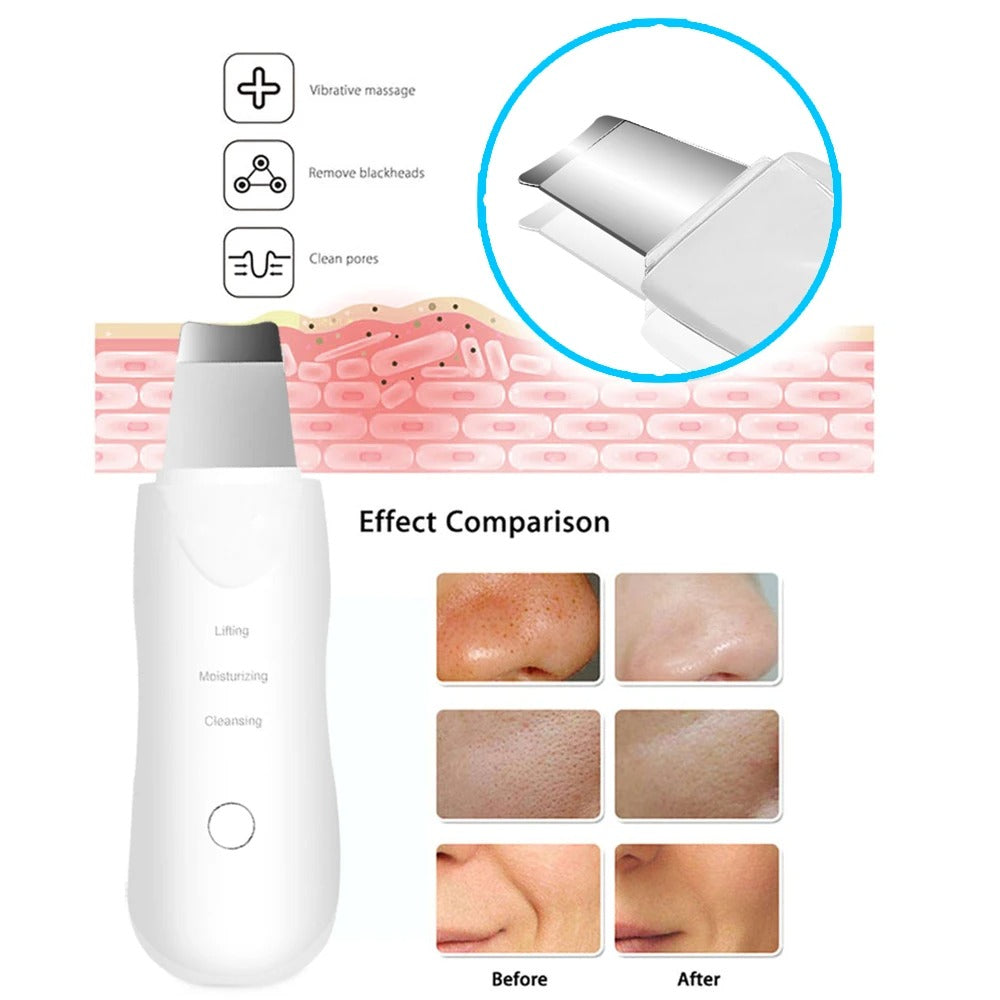 Ultrasonic Skin Scrubber – Deep Cleansing Sonic Wand for Removing Blackheads and Improving Skin Texture with Ionic Technology