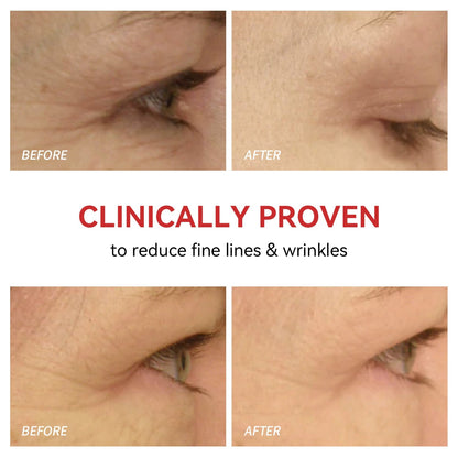 Red Light Therapy Device for Eyes | Reduces Fine Lines, Promotes Collagen & Effortless 3-Minute Daily Routine