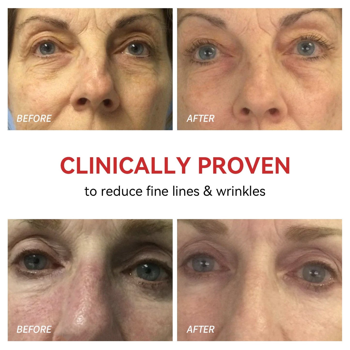 Red Light Therapy Device for Eyes | Reduces Fine Lines, Promotes Collagen & Effortless 3-Minute Daily Routine